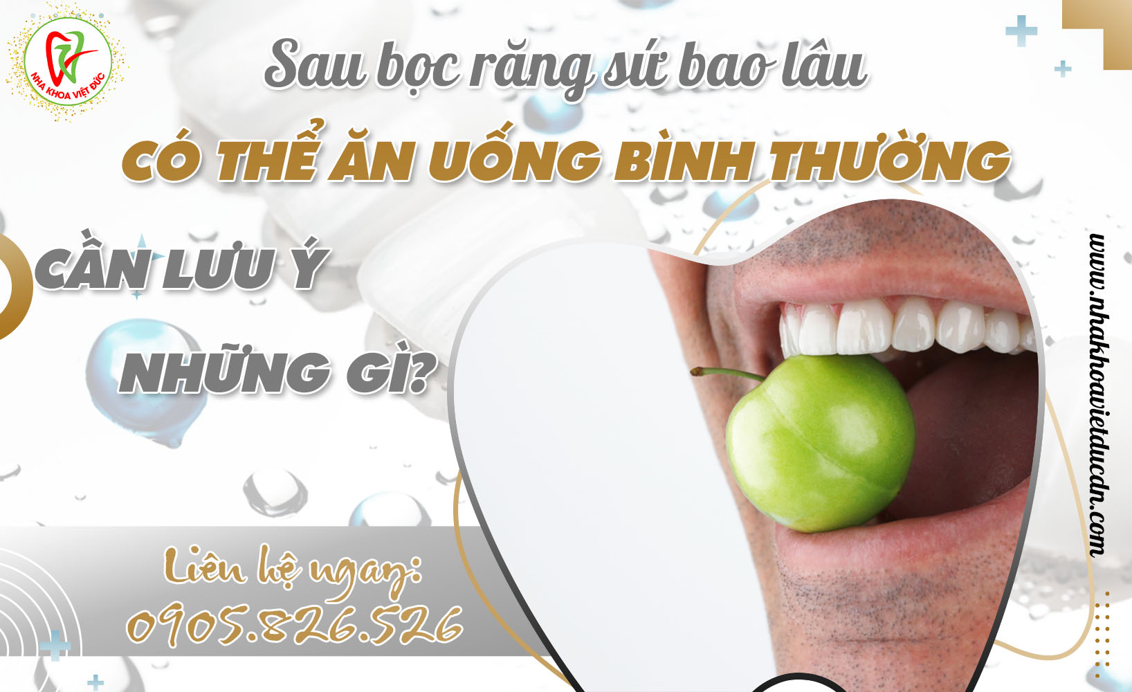 SAU BỌC RĂNG SỨ BAO LÂU CÓ THỂ ĂN UỐNG BÌNH THƯỜNG. CẦN LƯU Ý NHỮNG GÌ?