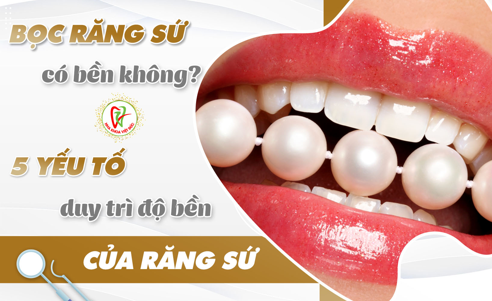 BỌC RĂNG SỨ CÓ BỀN KHÔNG? YẾU TỐ DUY TRÌ ĐỘ BỀN CỦA RĂNG SỨ