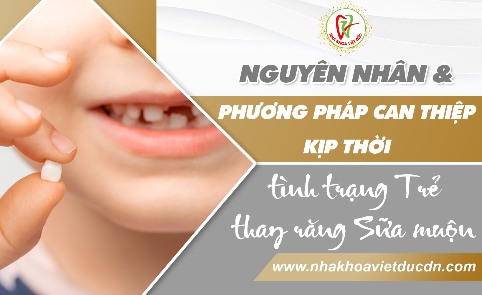 NGUYÊN NHÂN VÀ PHƯƠNG PHÁP CAN THIỆP KỊP THỜI TÌNH TRẠNG TRẺ THAY RĂNG SỮA MUỘN