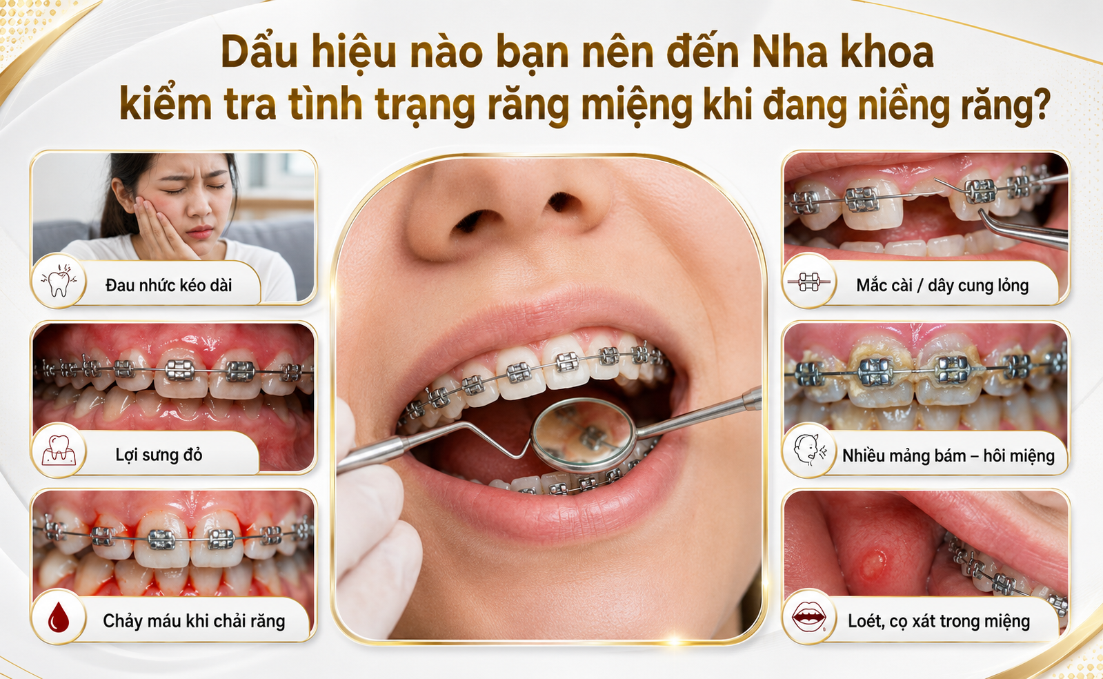 Dấu hiệu cần kiểm tra răng miệng khi đang niềng