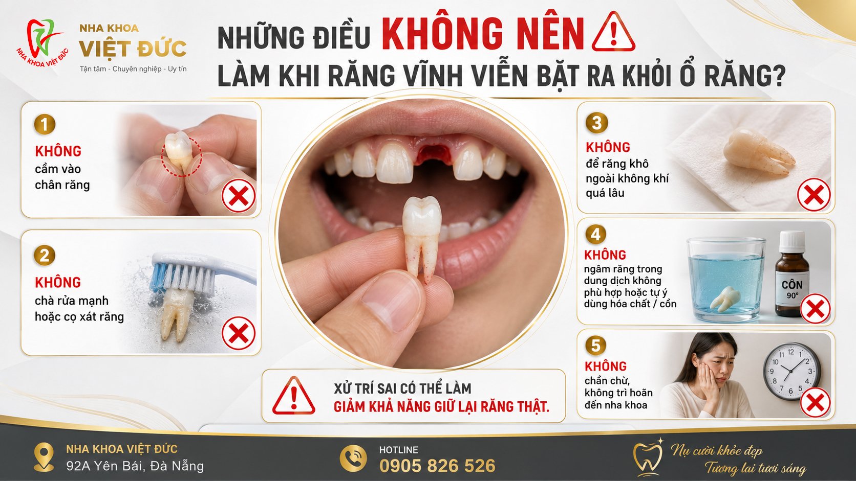 Các bước sơ cứu khi răng vĩnh viễn bật khỏi ổ