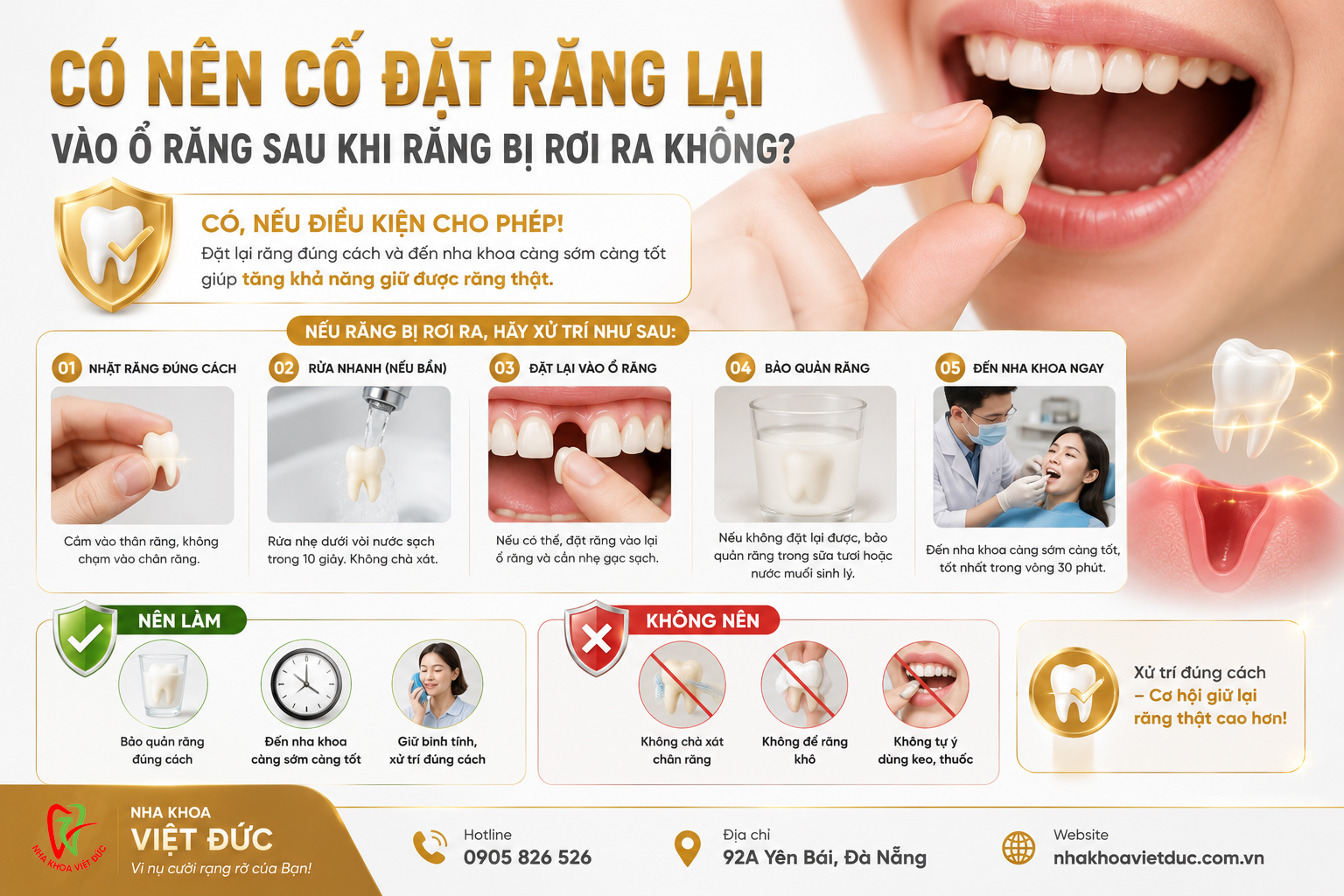 Các bước sơ cứu khi răng vĩnh viễn bật khỏi ổ