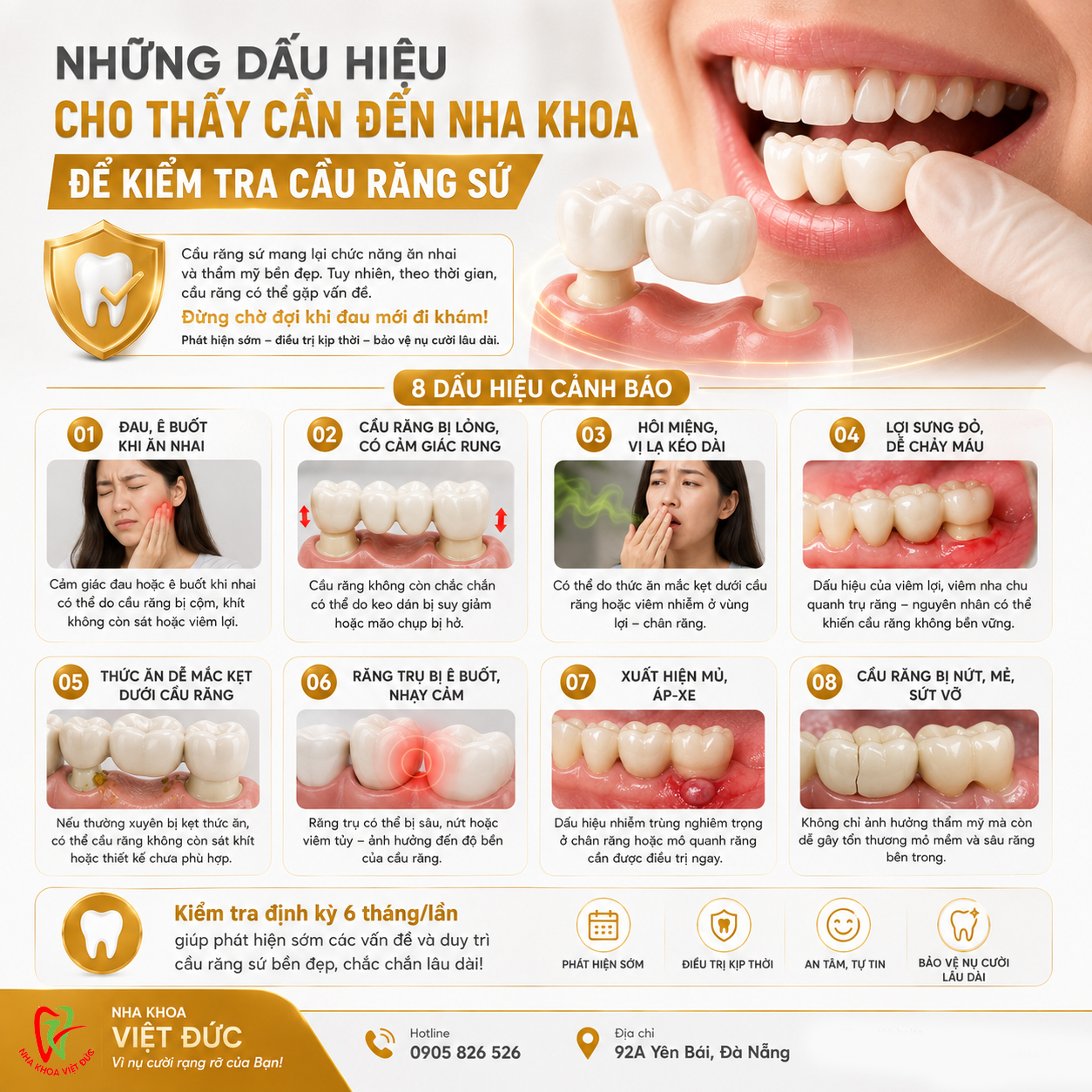 Dấu hiệu cầu răng sứ cần được nha sĩ kiểm tra