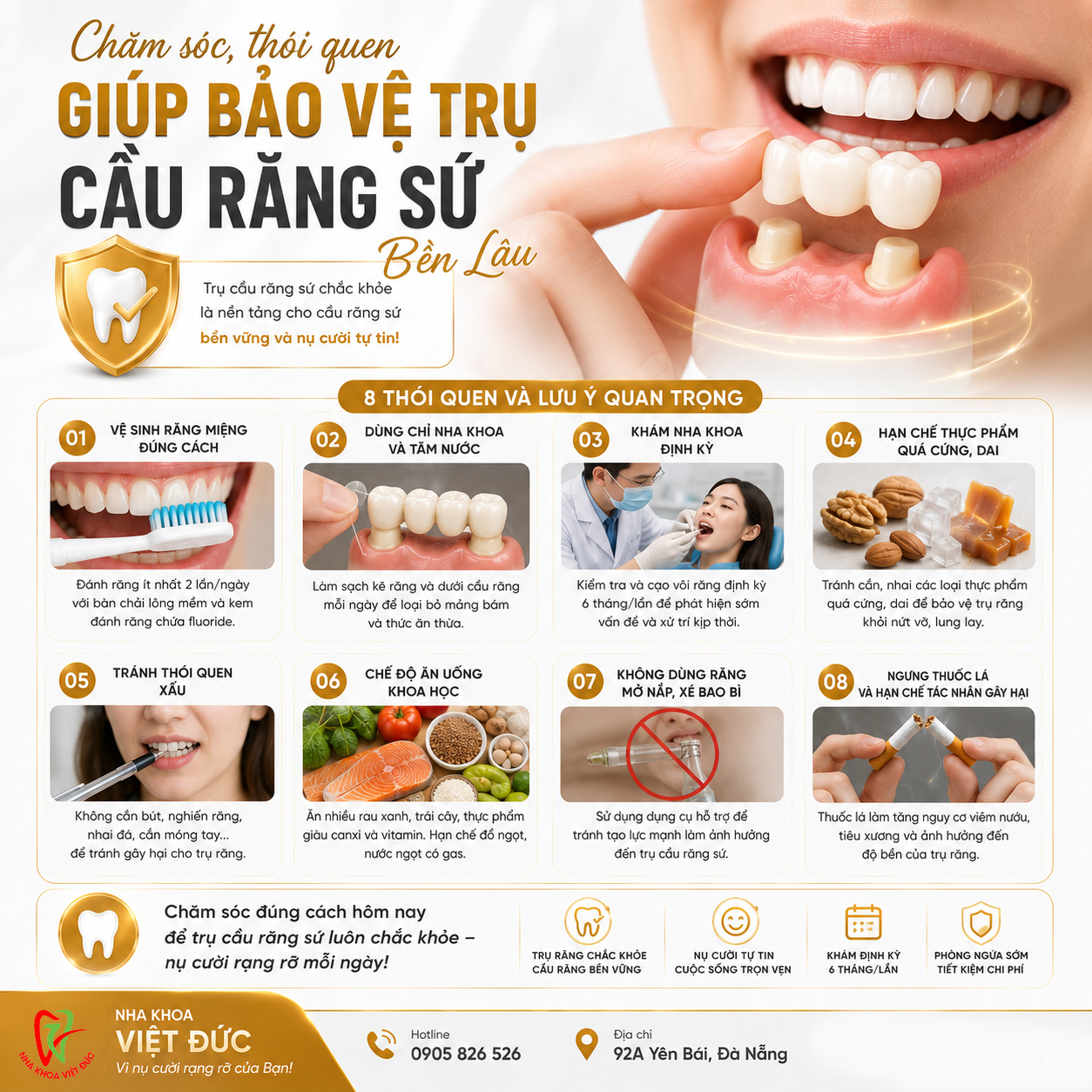 Thói quen giúp bảo vệ cầu răng sứ và răng trụ