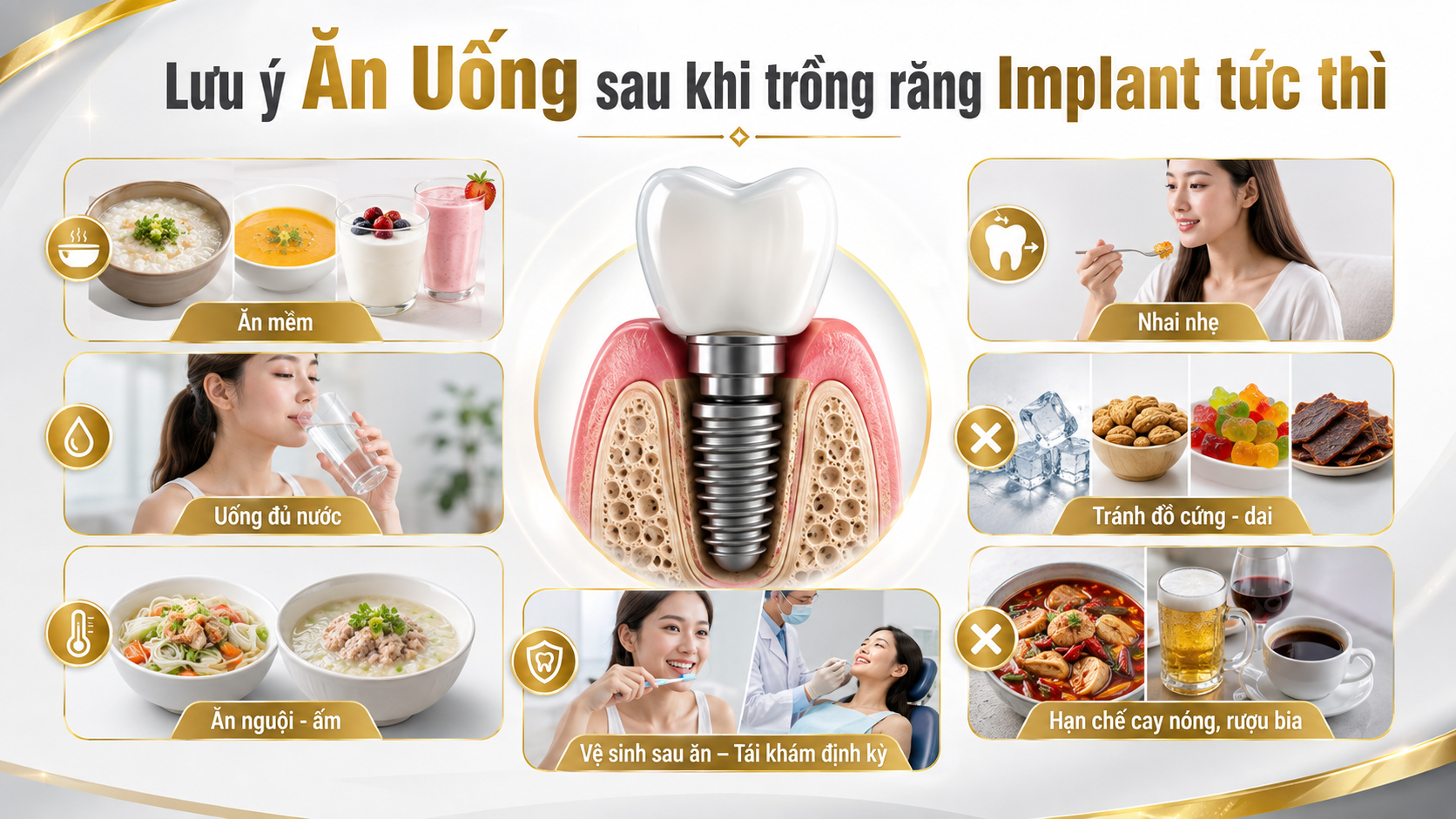 Minh họa hỗ trợ: Nhổ răng xong có đặt Implant ngay được không?